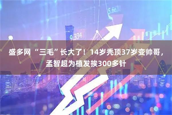 盛多网 “三毛”长大了！14岁秃顶37岁变帅哥，孟智超为植发挨300多针